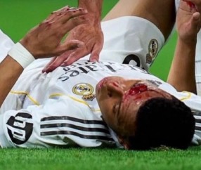 体育新闻-阿斯报：姆巴佩将首发出战拜仁，他不会佩戴面具